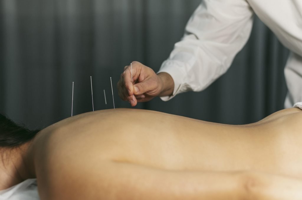 Acupuncturist in Tiel